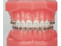 +détails : DOCTEUR OUEDRHIRI - Dentiste marrakech